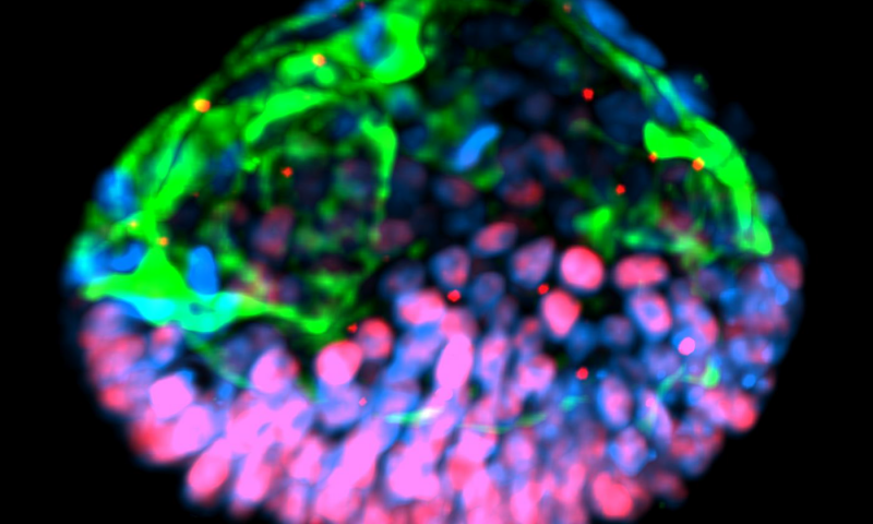盘中的羊膜囊 干细胞形成可能有助于不孕症研究的结构