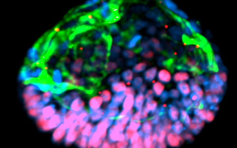 盘中的羊膜囊 干细胞形成可能有助于不孕症研究的结构