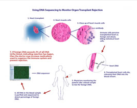 用DNA测序监测器官移植排斥反应