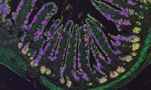稀有细胞是神经系统的进入肠道的窗口