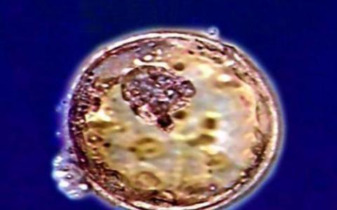 人类和猪胚胎的相似性提供了早期发育阶段的线索