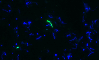 从温泉中揭开隐藏的微生物谱系