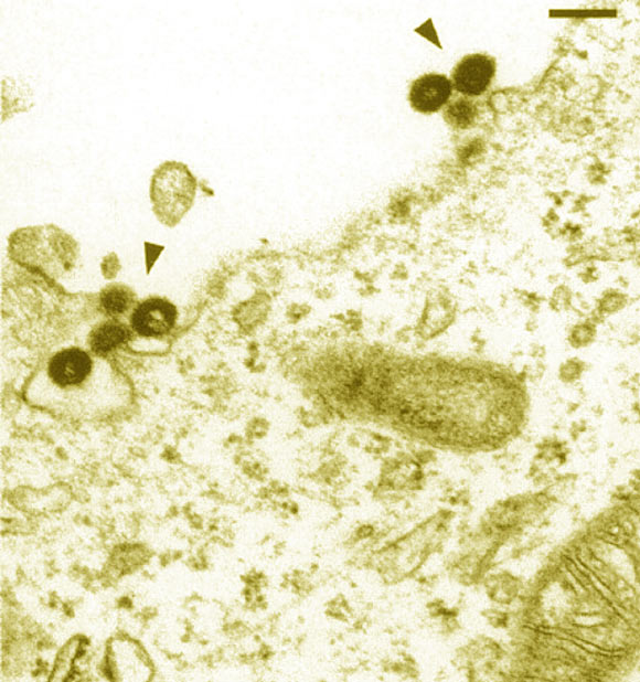 该电子显微照片显示2006年从人类DNA复活的原病毒颗粒。比例尺 -  200nm。 图片来源：Marie Dewannieux等。