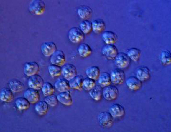 myxozoan物种Kudoa iwatai的新鲜孢子;  每个孢子的宽度为10微米。 图片来源：A。Diamant。