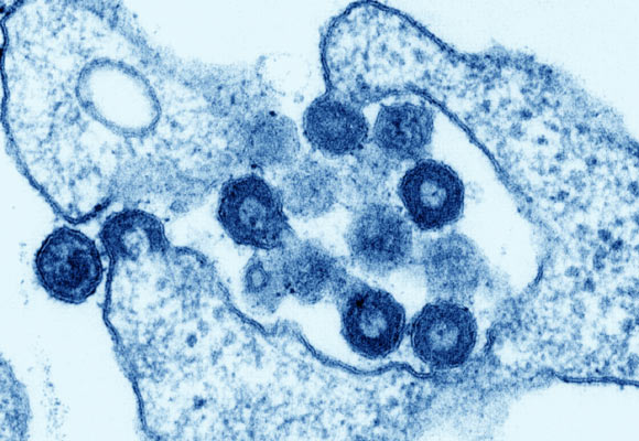 在癌细胞中的古代HML2病毒的病毒体。 图片来源：K。Boller / Paul-Ehrlich-Institute。