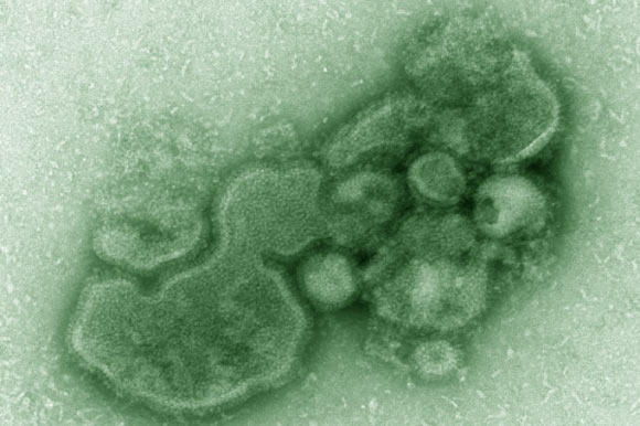 H7N9病毒的图像（Cynthia S. Goldsmith / Thomas Rowe）