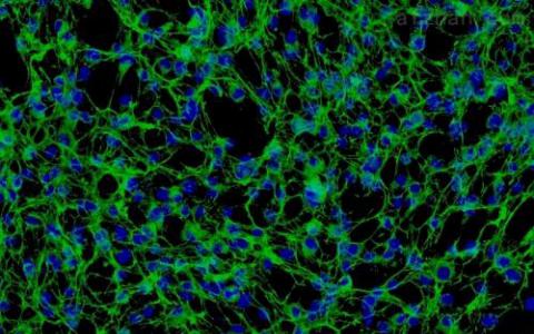 研究人员找到了人体最大的细胞受体