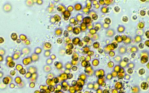 Dinoflagellate Genome令研究人员感到惊讶