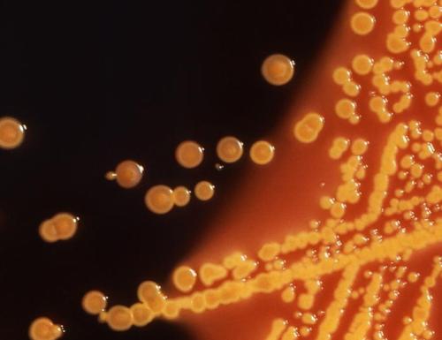 梦魇细菌的威胁表现出对最后抗生素粘菌素的抵抗力