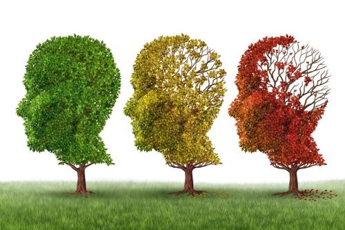 新的大脑在早期阿尔茨海默病中发生变化