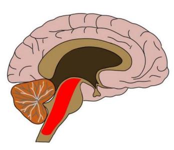 MRI技术在橄榄球运动员中显示出独特的脑震荡特征