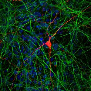 盘内相互连接的细胞让研究人员研究大脑疾病