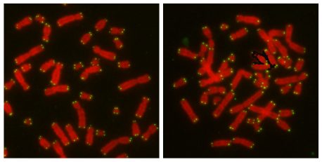 科学家发现一种微蛋白可以帮助细胞选择修复基因和避免癌症的最佳途径