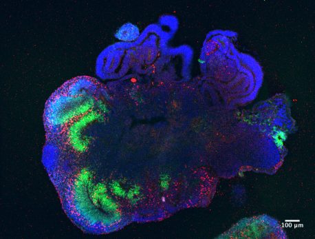 科学家们发现 3D迷你大脑为人类的发展和潜在的疾病治疗提供了新的视角