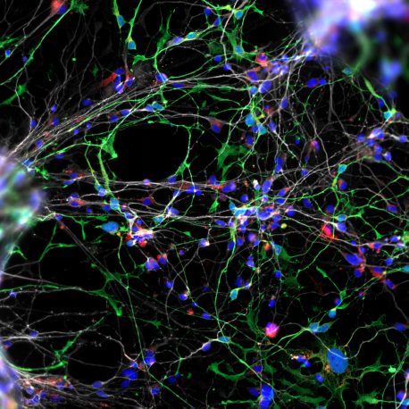 威廉斯综合症的神经发育模型为人类社会大脑的研究提供了新的视角