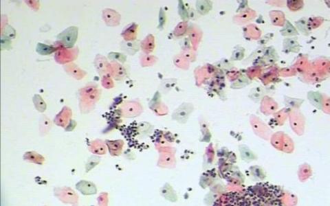 改变细胞行为可以促进生物燃料