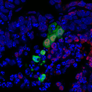新的干细胞可能会克服再生医学的障碍