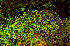 分离和生长乳腺组织干细胞的能力可以加速癌症研究