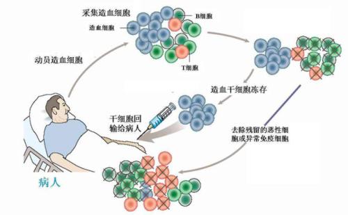 科学家阐明了一种更安全的干细胞治疗方法