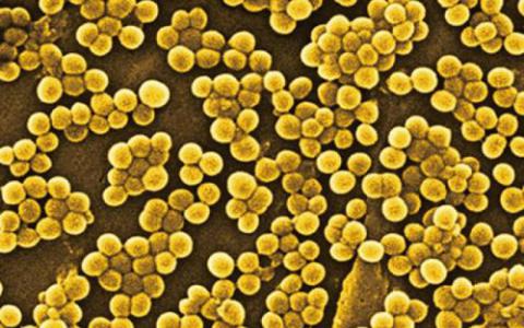 金黄色葡萄球菌具有阻碍某些抗菌药物的抗性策略