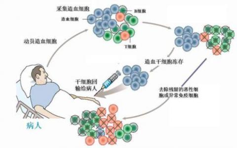 科学家阐明了一种更安全的干细胞治疗方法