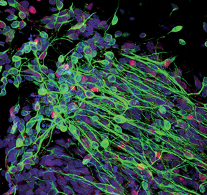 来自脐带血细胞的神经元可能代表新的治疗选择