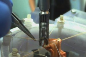 手术机器人独立地缝合组织切片并在猪中进行肠道手术