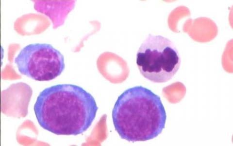 原始细胞类型不影响iPS细胞向血液的分化