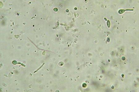 比较真菌分泌物以揭示碳化合物降解途径