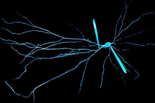 新方法允许分析来自组织的单个神经元