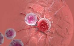 细胞死亡 蛋白质如何驱使免疫细胞自杀