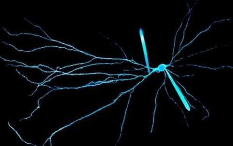 新方法允许分析来自组织的单个神经元