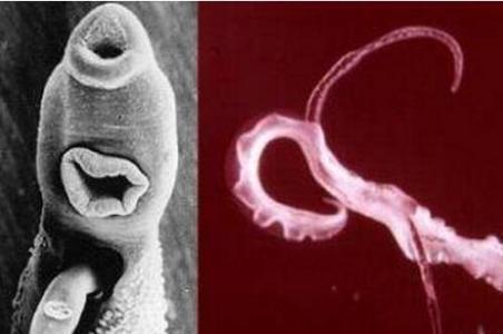研究人员确定血吸虫中精子生成所需的基因