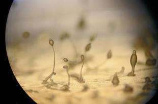 粘液霉菌可以深入了解无神经元生物的智力