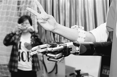 强化学习加速了机器人假肢的调整