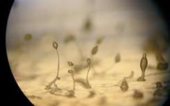 粘液霉菌可以深入了解无神经元生物的智力