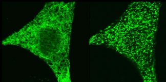 新的研究为控制免疫系统中异常的钙信号打开了大门