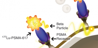 诺华制药以21亿美元收购Endocyte 扩大RLT治疗前列腺癌的渠道