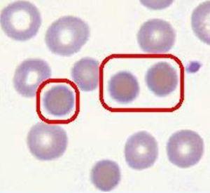 发现了红细胞的遗传密码