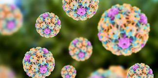 发现HPV亚型与艾滋病毒感染密切相关