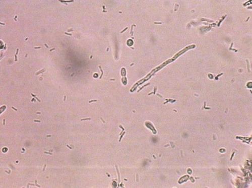 真菌孢子可能劫持人体免疫细胞传播感染