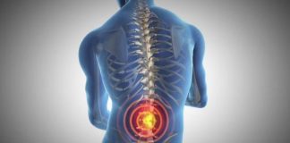 慢性背痛与三种基因变异有关