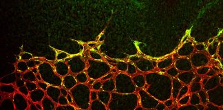 血液中的干细胞可以用来培养新的血管