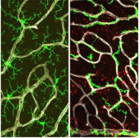 有缺陷的分子主开关可能有助于AMD