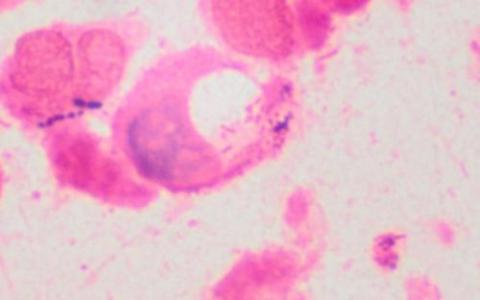 病毒会导致细菌产生粉红色的色素