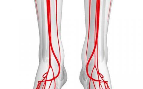 研究人员关注严重肢体缺血的最佳治疗指南