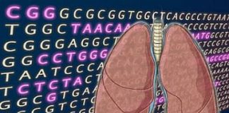 利用基因组学早期预测肺癌