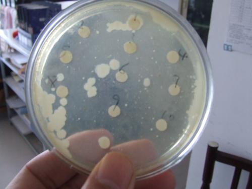沙门氏菌是打败免疫系统的奇怪方法