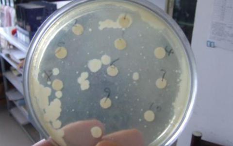 沙门氏菌是打败免疫系统的奇怪方法
