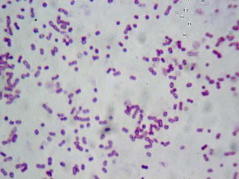 蜡状芽孢杆菌能够抵抗某些抗生素疗法